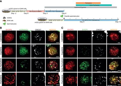 Meiotic Chromosome Synapsis and XY-Body Formation In Vitro